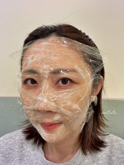 【台中】水天宮站|輕齡小資美學診所,雷神微針,打造細緻質感肌! - 第10張圖