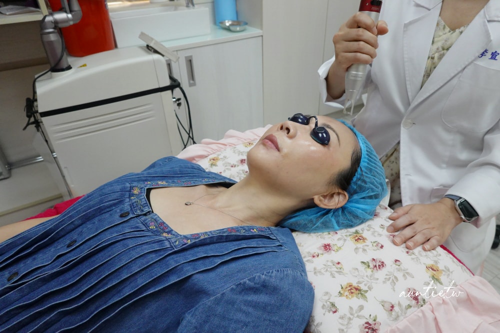 【台北】松江南京|台北彥靚診所,Picocare皮秒雷射+蜂巢探頭,細緻肌膚淡化瑕疵,台北皮秒推薦 - 第18張圖 【台北】松江南京|台北彥靚診所,Picocare皮秒雷射+蜂巢探頭,細緻肌膚淡化瑕疵,台北皮秒推薦