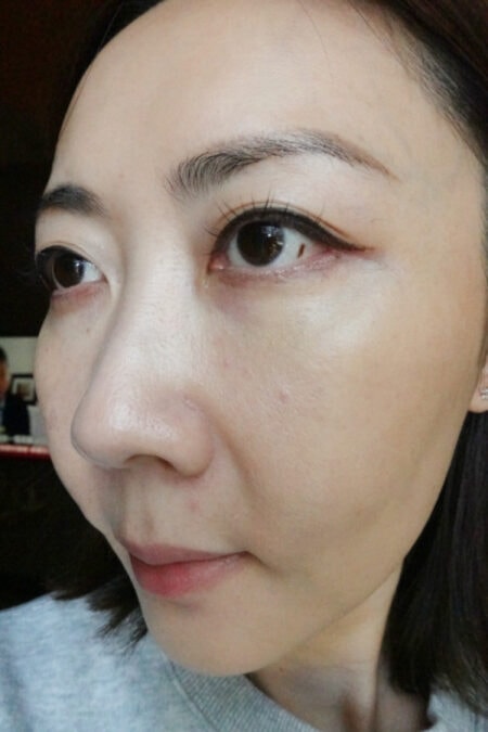 【台北】松江南京｜台北彥靚診所，Picocare皮秒雷射＋蜂巢探頭，細緻肌膚淡化瑕疵，台北皮秒推薦